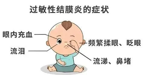 「科普」痒！痒！痒！—关于过敏性结膜炎-健康科普-漯河市中心医院
